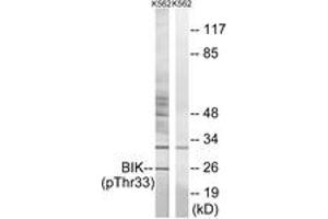 Western blot analysis of extracts from K562 cells, using BIK (Phospho-Thr33) Antibody. (BIK antibody  (pThr33))