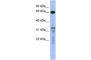 WB Suggested Anti-RAP1GAP  Antibody Titration: 0. (RAP1GAP antibody  (Middle Region))