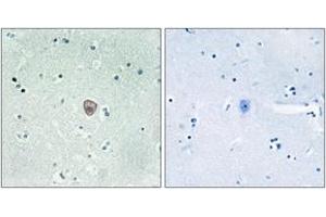 Immunohistochemistry analysis of paraffin-embedded human brain tissue, using EDG8 Antibody. (S1PR5 antibody  (AA 335-384))