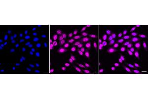 Immunocytochemical staining of HepG2 cells with Aryl hydrocarbon receptor antibody (ABIN7797656), 1:1,000). (Recombinant Aryl Hydrocarbon Receptor antibody)