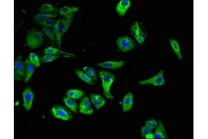Immunofluorescent analysis of HepG2 cells using ABIN7146093 at dilution of 1:100 and Alexa Fluor 488-congugated AffiniPure Goat Anti-Rabbit IgG(H+L) (CLEC7A antibody  (AA 1-44))