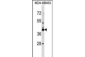 SRRD Antibody (Center) (ABIN1537981 and ABIN2848619) western blot analysis in MDA-M cell line lysates (35 μg/lane). (SRRD antibody  (AA 184-213))
