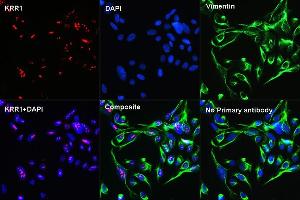 Confocal Immunofluorescence analysis of U2OS cells using KRR1 Rabbit pAb  at dilution of 1:100 (40x lens)(red). (Vimentin antibody)