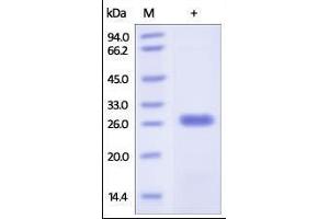 Human Bcl-x, His Tag on SDS-PAGE under reducing (R) condition. (BCL2L1 Protein (AA 1-212) (His tag))