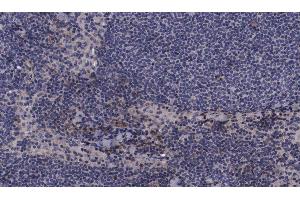 ABIN6267536 at 1/100 staining human lymph node tissue sections by IHC-P.