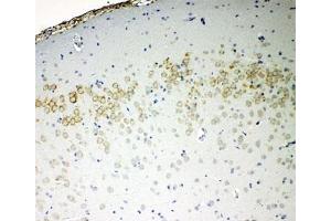 Immunohistochemistry (IHC) image for anti-Cadherin 5 (CDH5) (AA 766-784) antibody (ABIN3028523)
