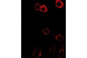 Immunofluorescent analysis of HSD17B2 staining in SW480 cells. (HSD17B2 antibody)