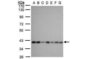 WB Image Sample(30 ug whole cell lysate) A: 293T B: A431 , C: H1299 D: HeLa S3 , E: Hep G2 , F: MOLT4 , G: Raji , 10% SDS PAGE antibody diluted at 1:1000 (SLC25A33 antibody)