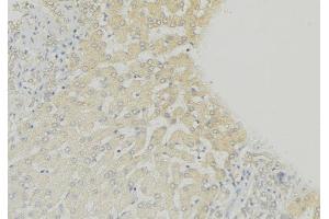 ABIN6274999 at 1/100 staining Mouse liver tissue by IHC-P.