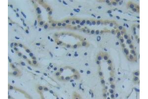 Immunohistochemistry (IHC) image for anti-Tumor Necrosis Factor Receptor Superfamily, Member 1A (TNFRSF1A) (AA 60-236) antibody (ABIN7436807)