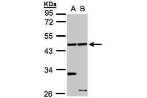 WB Image Sample(30 ug whole cell lysate) A:A431, B:Hep G2 , 10% SDS PAGE antibody diluted at 1:1000 (Ethanolamine Kinase 1 antibody)