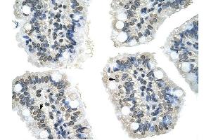 GIPC2 antibody was used for immunohistochemistry at a concentration of 4-8 ug/ml to stain Epithelial cells of intestinal villus (arrows) in Human Intestine. (GIPC2 antibody  (N-Term))