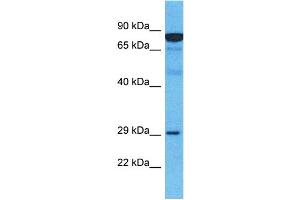 Host:  Rabbit  Target Name:  MARCH2  Sample Type:  Esophagus Tumor lysates  Antibody Dilution:  1. (MARCH2 antibody  (C-Term))