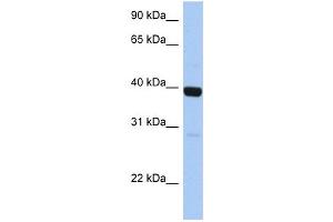 WB Suggested Anti-ZNF385B Antibody Titration:  0. (ZNF385B antibody  (C-Term))