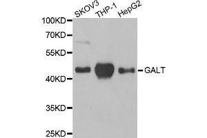 Western Blotting (WB) image for anti-Galactose-1-Phosphate Uridylyltransferase (GALT) antibody (ABIN1980308) (GALT antibody)