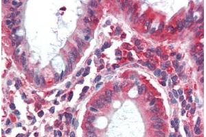 Human Colon (formalin-fixed, paraffin-embedded) stained with MYO5B antibody ABIN396915 at 20 ug/ml followed by biotinylated goat anti-rabbit IgG secondary antibody ABIN481713, alkaline phosphatase-streptavidin and chromogen. (MYO5B antibody  (C-Term))