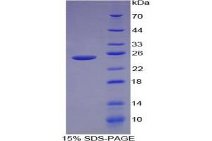 SDS-PAGE analysis of Human Caldesmon Protein. (Caldesmon Protein)
