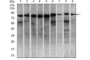 Western blot analysis using MARK3 antibody against HeLa (1), SK-N-SH (2), K562 (3), HCT116 (4), HEK293 (5), 3T3L1 (6), NIH3T3 (7), Jurkat (8), and A431 (9) cell lysate. (MARK3 antibody  (AA 435-658))