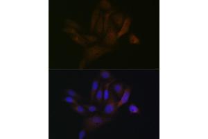 Immunofluorescence analysis of U-2 OS cells using B Rabbit mAb (ABIN1680181, ABIN7101458, ABIN7101459 and ABIN7101460) at dilution of 1:100 (40x lens). (BCAP31 antibody)