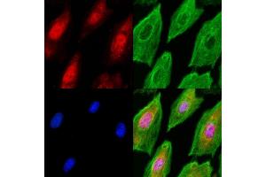 ABIN6260731 and ABIN6278203 staining  cells(UV treatment) by IF/ICC.