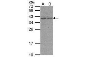 Image no. 1 for anti-X-Ray Repair Complementing Defective Repair in Chinese Hamster Cells 3 (XRCC3) (AA 1-128) antibody (ABIN467379) (XRCC3 antibody  (AA 1-128))