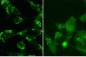 Immunohistochemistry (IHC) image for anti-Microtubule-Associated Protein 1 Light Chain 3 beta (MAP1LC3B) (cleaved) antibody (ABIN2999910) (LC3B antibody  (cleaved))