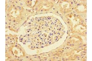 Immunohistochemistry of paraffin-embedded human kidney tissue using ABIN7170239 at dilution of 1:100 (SLC35F6 antibody  (AA 337-371))