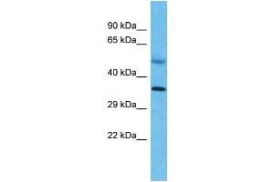 Western Blotting (WB) image for anti-Small Nuclear RNA Activating Complex, Polypeptide 2, 45kDa (SNAPC2) (C-Term) antibody (ABIN2773777)