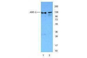 Western Blotting (WB) image for anti-WD Repeat and HMG-Box DNA Binding Protein 1 (WDHD1) antibody (ABIN2664053) (WDHD1 antibody)