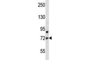 Western Blotting (WB) image for anti-Forkhead Box O3 (FOXO3) (AA 224-253) antibody (ABIN3030991)