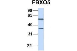 Host:  Rabbit  Target Name:  FBXO5  Sample Type:  Human Fetal Lung  Antibody Dilution:  1. (FBXO5 antibody  (C-Term))