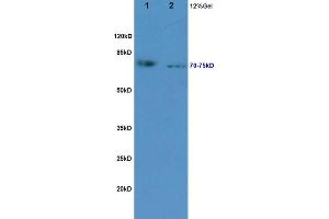 L1 rat kidney lysates L2 rat pancreas lysates probed with Anti NLG1/KIRREL2 Polyclonal Antibody, Unconjugated (ABIN720460) at 1:200 in 4 °C. (KIRREL2 antibody  (AA 165-260))