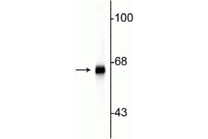 Western blot of rat cortex lysate showing specific immunolabeling of the ~ 66 kDa alpha internexin protein. (INA antibody)