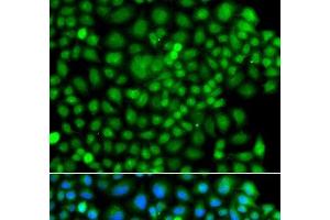 Immunofluorescence analysis of A549 cells using SUMO4 Polyclonal Antibody (SUMO4 antibody)