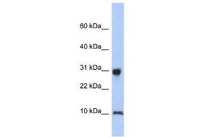 RPS21 antibody used at 1 ug/ml to detect target protein. (RPS21 antibody  (N-Term))