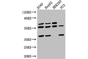 Western Blot Positive WB detected in: A549 whole cell lysate, HepG2 whole cell lysate, HEK293 whole cell lysate, PC-3 whole cell lysate All lanes: TAF1A antibody at 2. (TAF1A antibody  (AA 251-325))