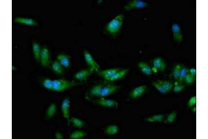 Immunofluorescent analysis of Hela cells using ABIN7148679 at dilution of 1:100 and Alexa Fluor 488-congugated AffiniPure Goat Anti-Rabbit IgG(H+L) (CRTC2 antibody  (AA 180-372))