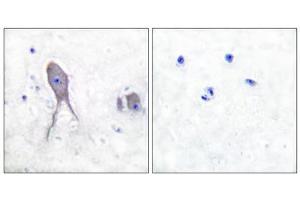Immunohistochemical analysis of paraffin-embedded human brain tissue, using Notch 2 (cleaved-Asp1733) antibody.