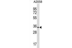 Western Blotting (WB) image for anti-Olfactory Receptor, Family 2, Subfamily T, Member 35 (OR2T35) antibody (ABIN3000665) (OR2T35 antibody)