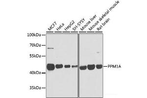 Western blot analysis of extracts of various cell lines using PPM1A Polyclonal Antibody at dilution of 1:1000.