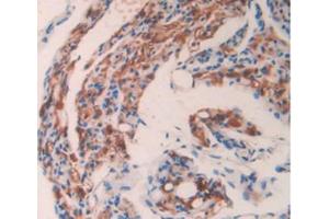 IHC-P analysis of Mouse Ovary Tissue, with DAB staining. (GAS6 antibody  (AA 483-646))