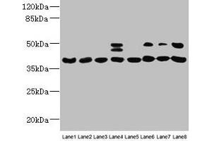 Western blot All lanes: HIF1AN antibody at 12 μg/mL Lane 1: Mouse heart tissue Lane 2: Mouse skeletal muscle tissue Lane 3: K562 whole cell lysate Lane 4: MCF-7 whole cell lysate Lane 5: HL60 whole cell lysate Lane 6: 293T whole cell lysate Lane 7: Jurkat whole cell lysate Lane 8: A375 whole cell lysate Secondary Goat polyclonal to rabbit IgG at 1/10000 dilution Predicted band size: 41 kDa Observed band size: 41, 48 kDa (HIF1AN antibody  (AA 2-254))