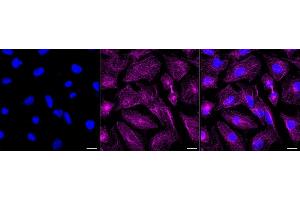 anti-Microtubule-Associated Protein, RP/EB Family, Member 3 (MAPRE3) antibody