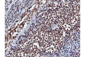 Image no. 2 for anti-V-Akt Murine Thymoma Viral Oncogene Homolog 1 (AKT1) antibody (ABIN1496557) (AKT1 antibody)