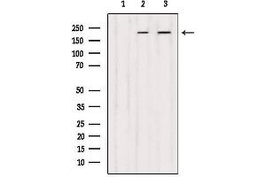 Western blot analysis of extracts from various samples, using DOCK1 Antibody.