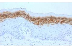 Immunohistochemical staining (Formalin-fixed paraffin-embedded sections) of human skin with FLG monoclonal antibody, clone FLG/1561 . (Filaggrin antibody  (AA 998-1104))
