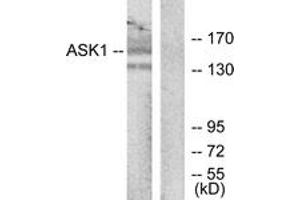 Western blot analysis of extracts from RAW264. (ASK1 antibody  (AA 932-981))