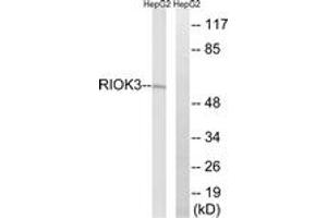 Western blot analysis of extracts from HepG2 cells, using RIOK3 Antibody. (RIOK3 antibody  (AA 271-320))