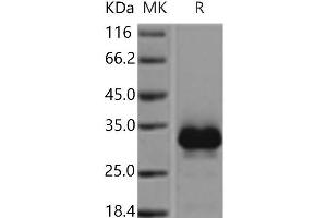 Western Blotting (WB) image for Tumor Necrosis Factor Receptor Superfamily, Member 11a, NFKB Activator (TNFRSF11A) protein (His tag) (ABIN7198426) (TNFRSF11A Protein (His tag))
