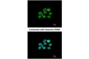 ICC/IF Image Immunofluorescence analysis of paraformaldehyde-fixed A431, using KAP1, antibody at 1:200 dilution. (KAP1 antibody)